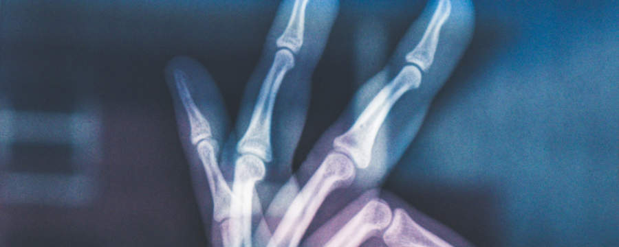 Ostéoporose et bilan phosphocalcique – DiagnoVie – Laboratoire de ...